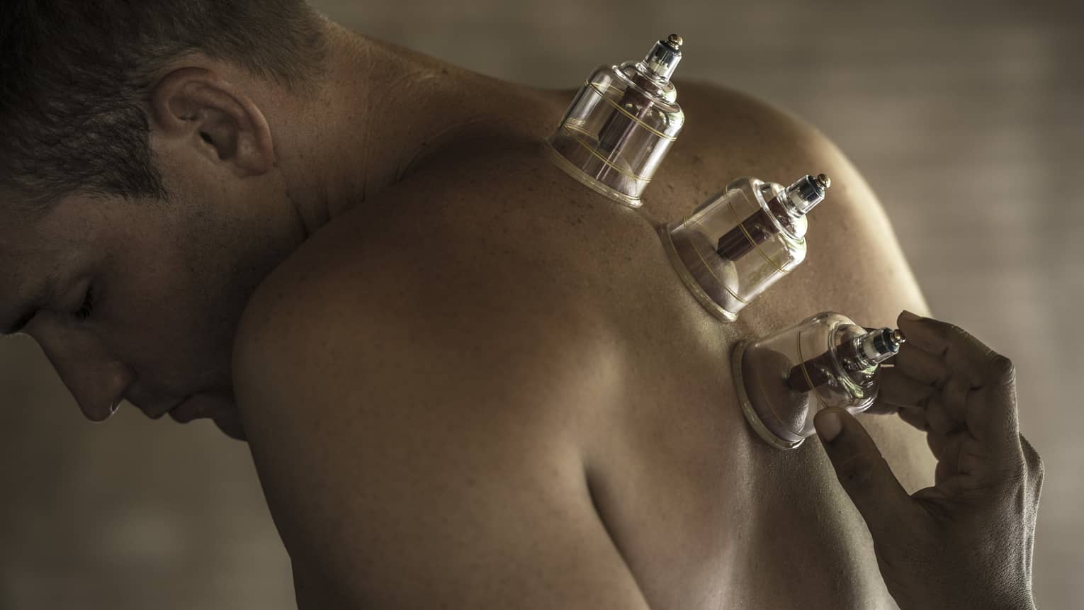 Three suction cups along man's spine and bare back during massage