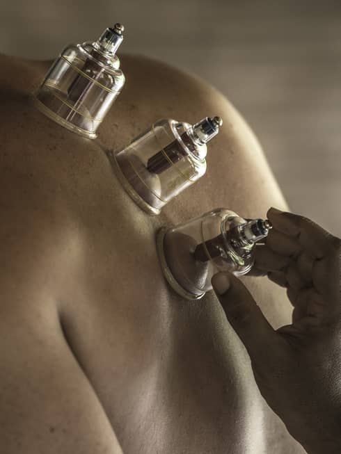 Three suction cups along man's spine and bare back during massage