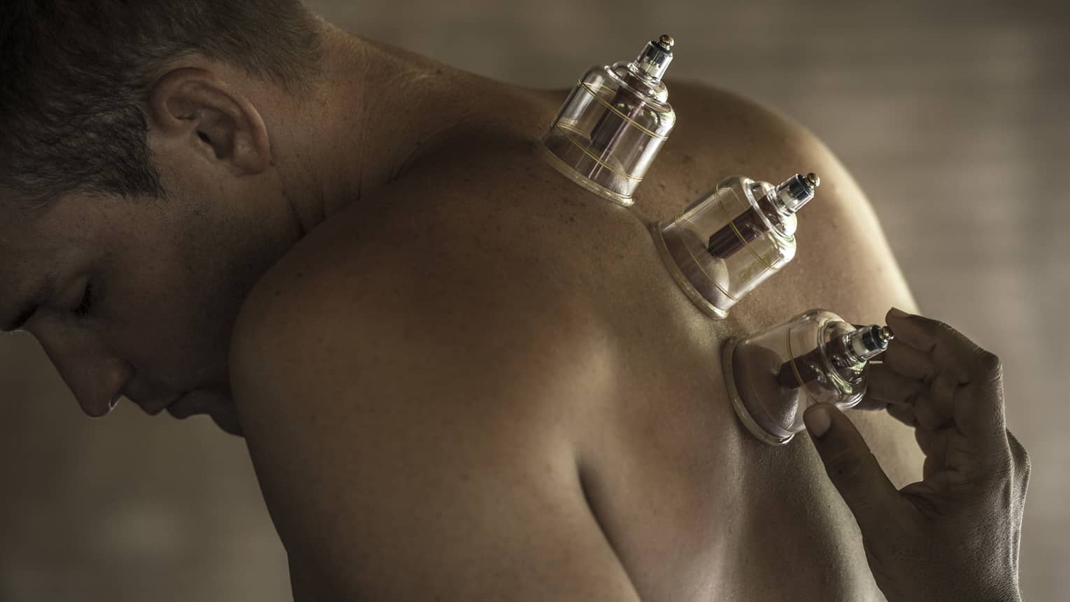 Three suction cups along man's spine and bare back during massage