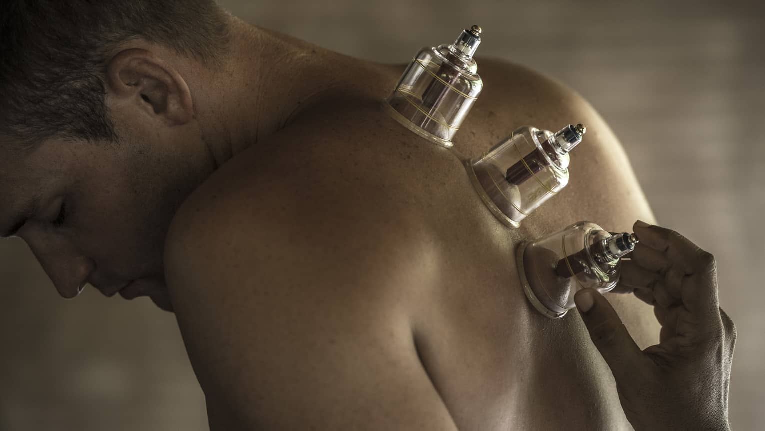 Three suction cups along man's spine and bare back during massage