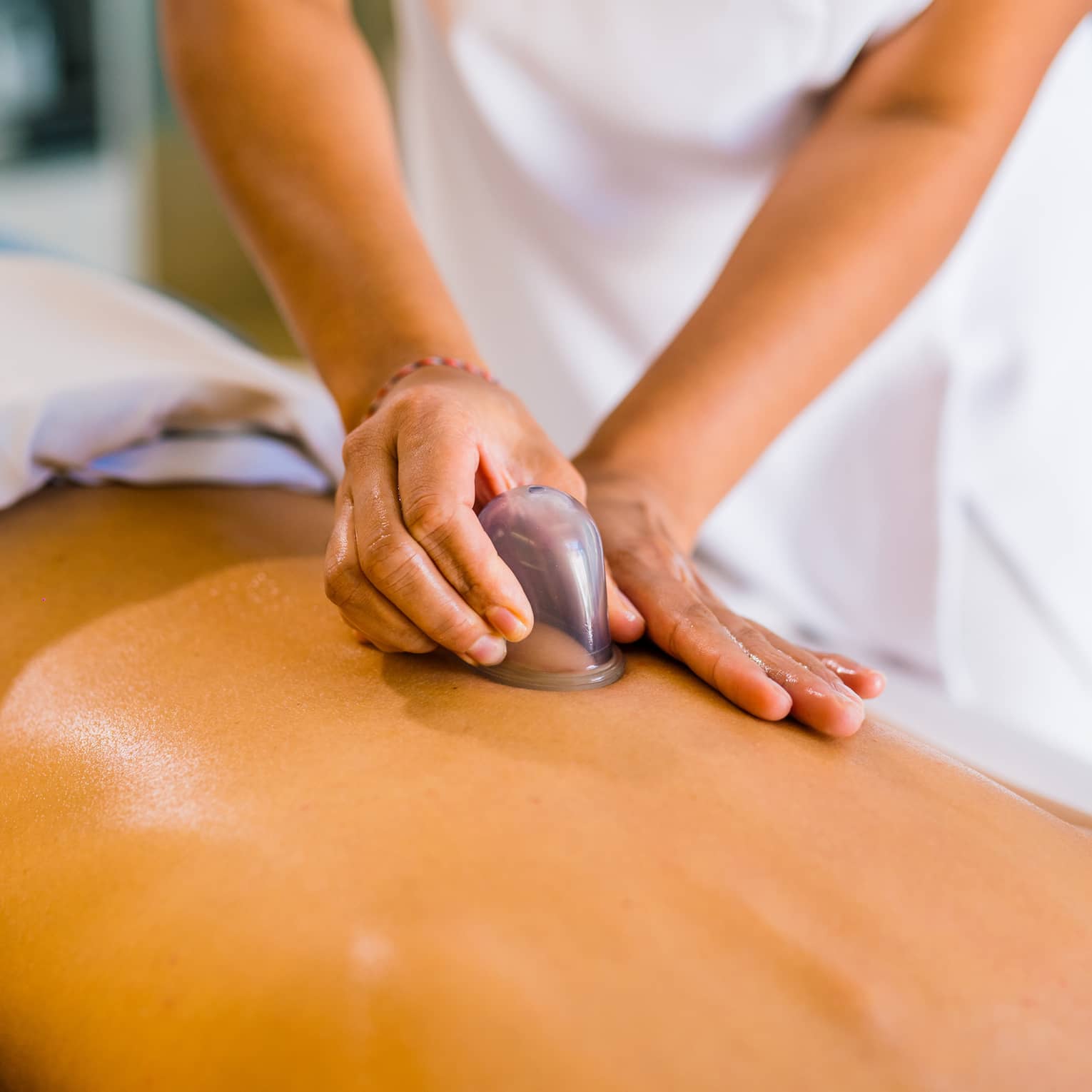 A woman lays on a massage table as a masseuse puts a cup on her back.