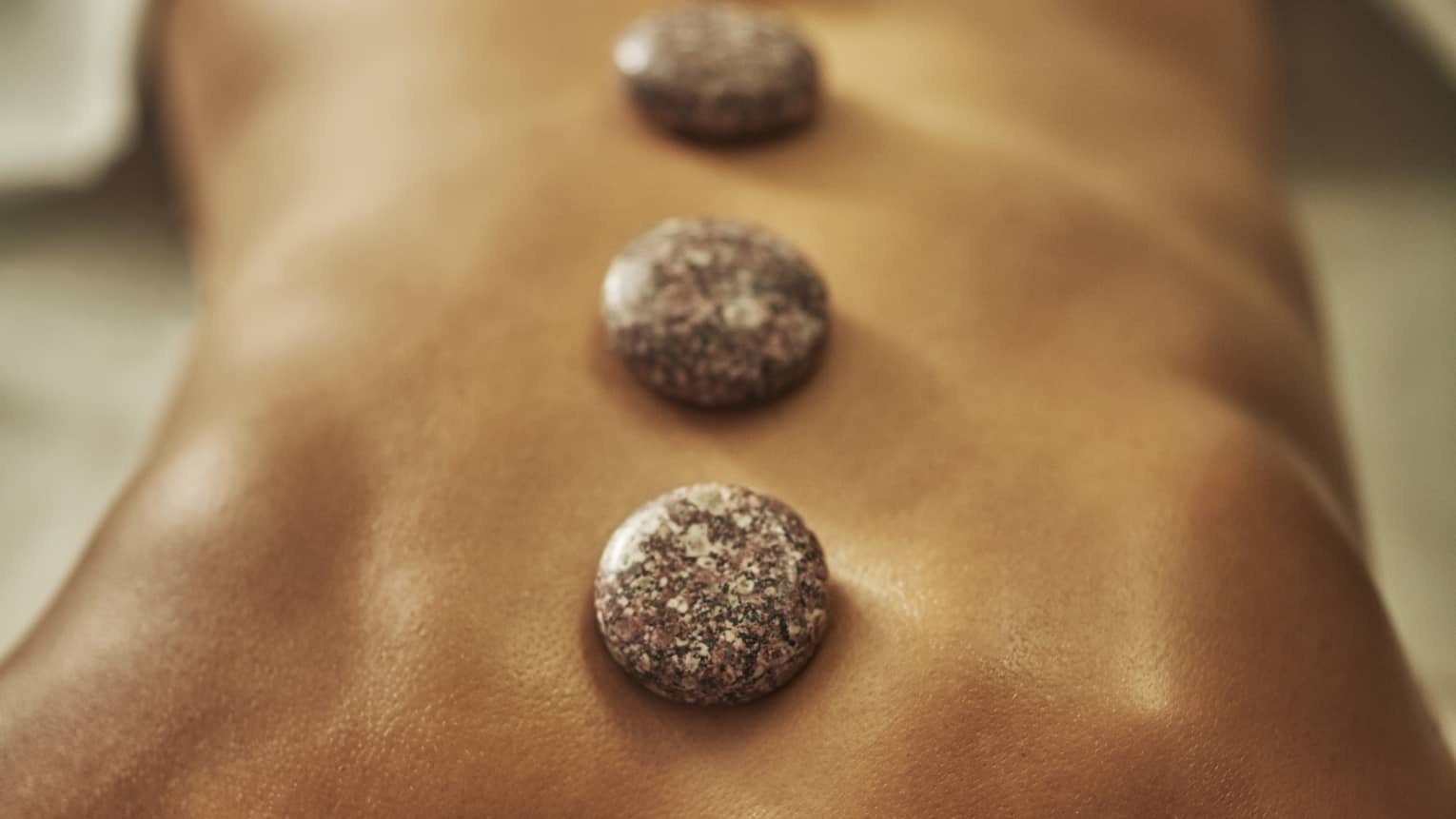 A woman lies on a spa table with four hot stones laid on her back